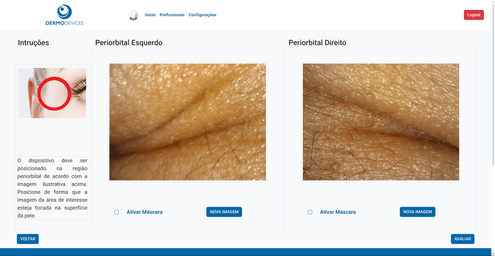 Skin Analyser versão Web